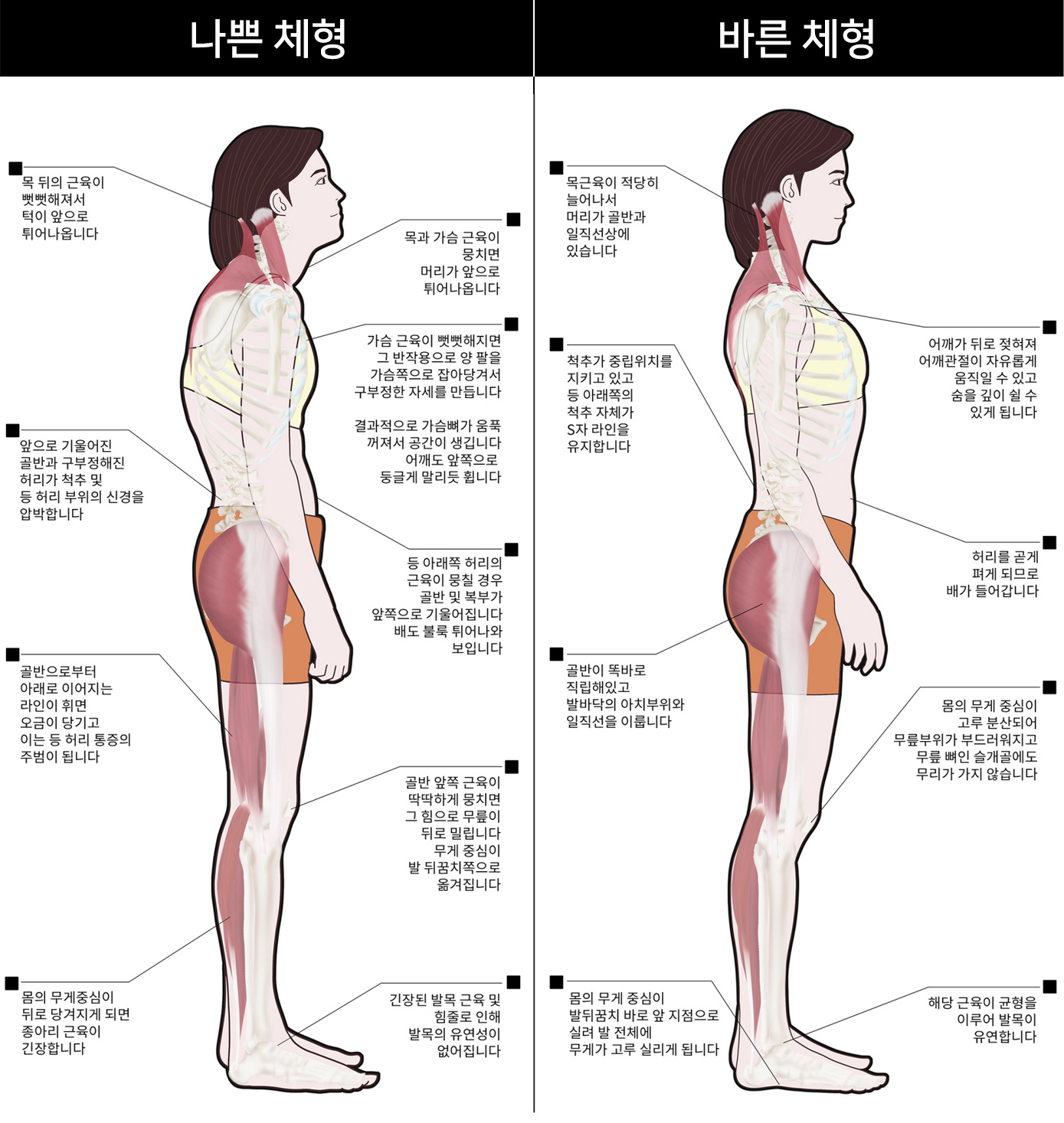 나쁜체형과바른체형